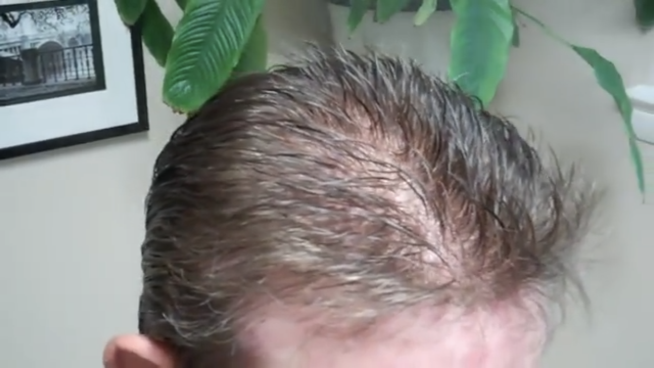 Scalp build up removal deals